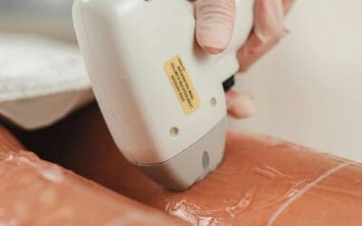 Why Spring Is the Perfect Time to Start Laser Hair Removal in Bolton