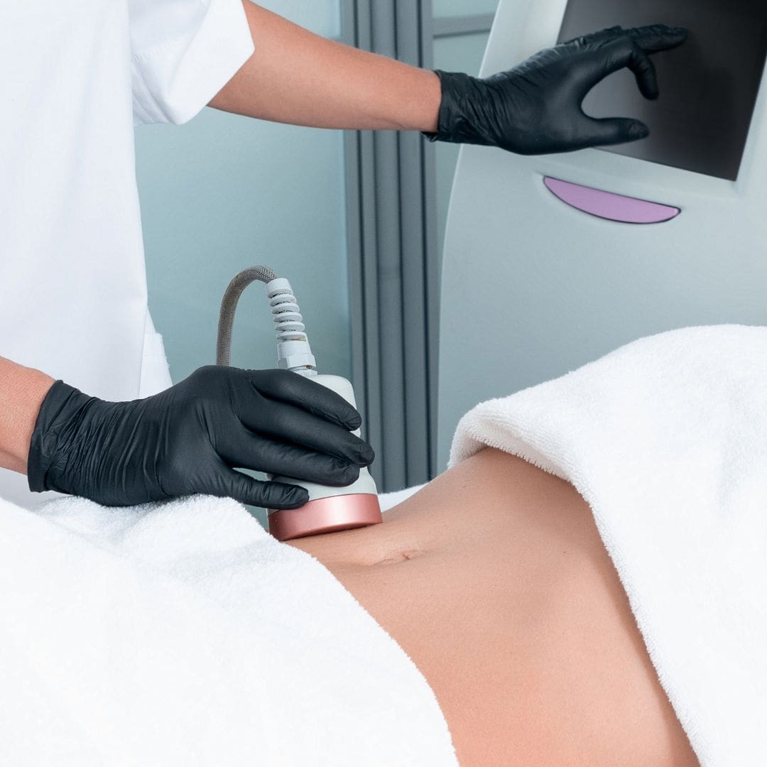 Body contouring treatment on the thigh